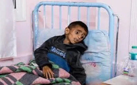 التنسيق البريطاني مع الصحة العالمية لإنقاذ أطفال غزة في ظل انهيار النظام الصحي