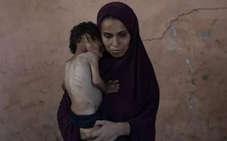 ارتفاع عدد ضحايا المجاعة وسوء التغذية في غزة إلى 8 خلال يوم واحد