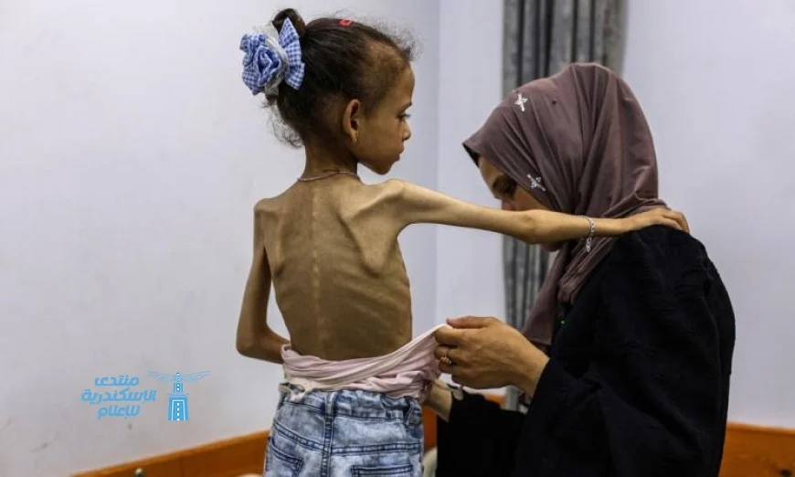 الوضع الإنساني في غزة: تحديات الإغاثة الطبية تحت وابل القصف المستمر