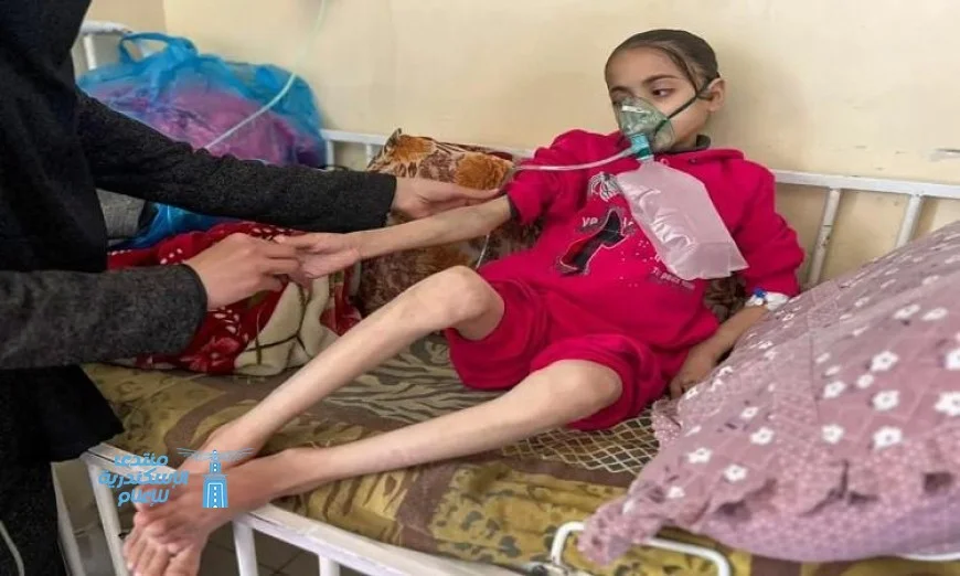 استشهاد 3 فلسطينيين في غزة نتيجة المجاعة وأزمة سوء التغذية