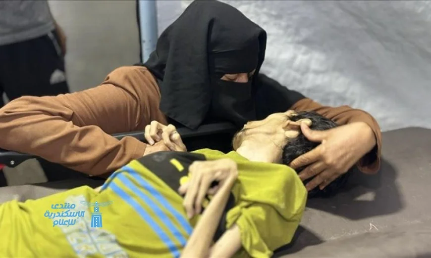 مأساة غزة: وفاة 7 فلسطينيين بسبب التجويع وسوء التغذية