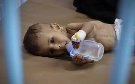 ارتفاع قياسي في معدل سوء التغذية بين أطفال غزة بحسب تقرير اليونيسف