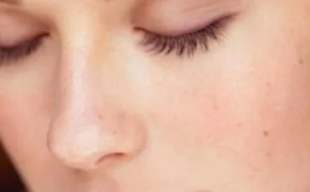 ست نصائح فعّالة للعناية ببشرتك الدهنية وتحسين مظهرها