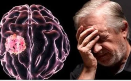 دراسة جديدة تبرز تعديلا غذائيا يعزز قابلية علاج سرطان المخ بشكل فعّال