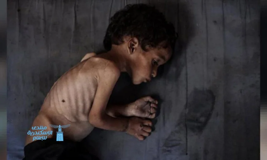 مأساة الجوع تفجع فلسطين وفاة 5 أشخاص بينهم 3 أطفال في يوم واحد