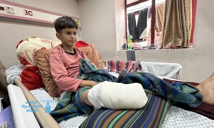منظمة الصحة العالمية تكشف عن إصابات مسببة للإعاقات لـ42 ألف شخص في غزة