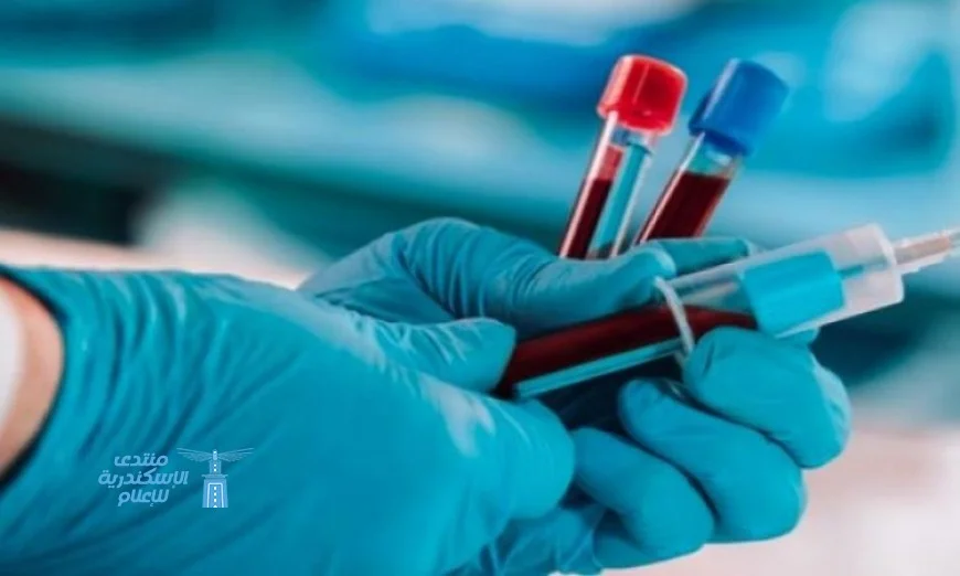 علماء يحققون إنجازاً علمياً بترقية فصيلة دم كلية وزراعتها بنجاح