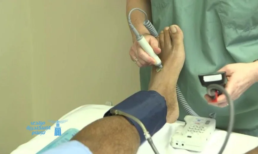 اكتشاف ثوري في قياس ضغط الدم يعد بتحويل الطريقة التقليدية للأبد