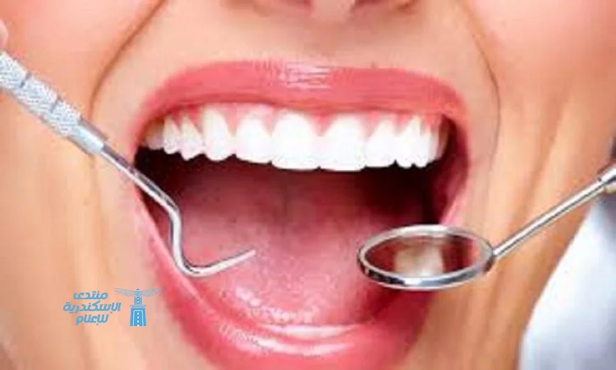 طرق فعالة لتبييض الأسنان في المنزل بمواد طبيعية