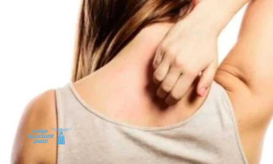 دراسة تكشف أن لقاح الحزام الناري يقلل خطر الإصابة بالخرف بنسبة 50%