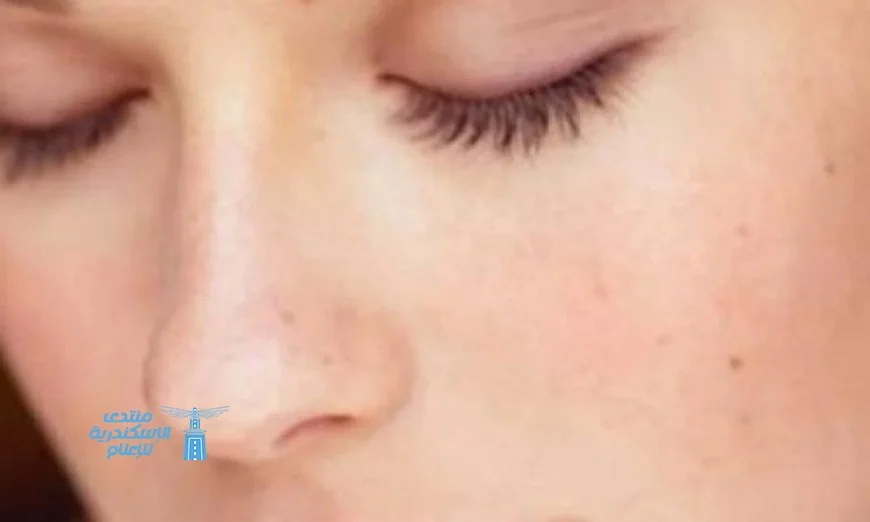 أفضل الوصفات الطبيعية للحصول على بشرة موحدة اللون