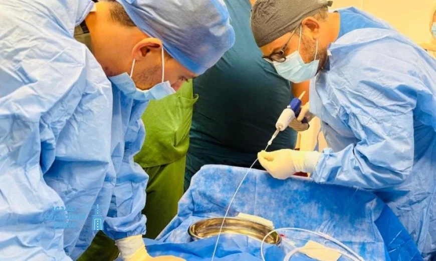 إطلاق ورشة تدريبية جديدة لعلاج دوالي الساقين باستعمال تقنية الصمغ الطبي في بورسعيد