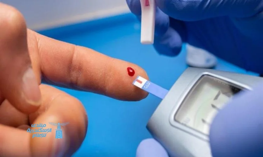 دراسة تكشف عن استراتيجيات فعالة لتقليل مضاعفات مرض السكري