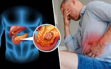 علماء أسبان يحققون إنجازا مذهلا في علاج سرطان البنكرياس من خلال نهج ثلاثي مبتكر