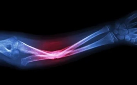 ابتكار جديد يستخدم مخلفات الأسماك لتعزيز نمو العظام بفعالية