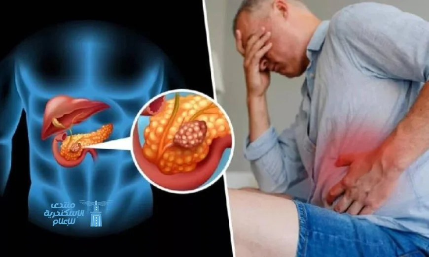 علماء أسبان يحققون إنجازا مذهلا في علاج سرطان البنكرياس من خلال نهج ثلاثي مبتكر