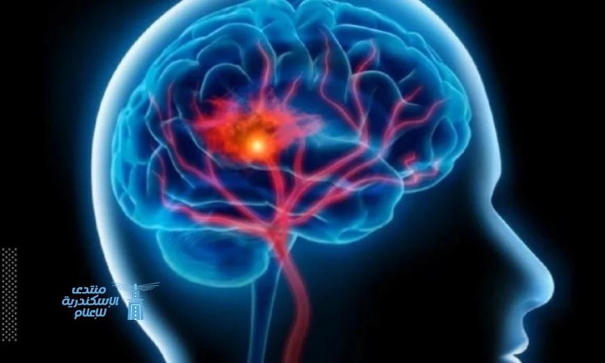 دراسة تكشف تأثير أماكن تخزين الدهون في الجسم على صحة الدماغ