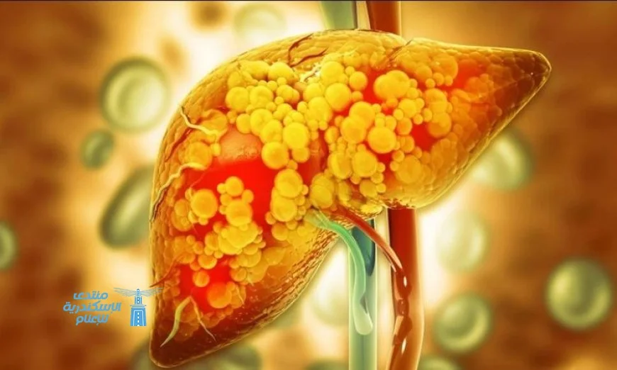 اكتشاف مركب معوي جديد يعزز صحة الكبد ويخفض خطر الكبد الدهني لدى الأطفال