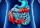 اكتشاف جديد يحقق الأمل لمرضى تليف الأمعاء وينهي معاناتهم