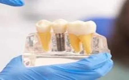 ابتكار مادة حيوية ثورية تعيد تعريف علاج وترميم الأسنان