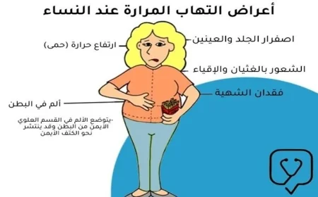 كل ما تحتاج معرفته عن أعراض حصوات المرارة عند النساء ووسائل العلاج الفعالة