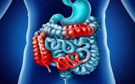 اكتشاف جديد يحقق الأمل لمرضى تليف الأمعاء وينهي معاناتهم