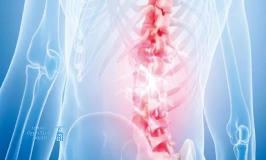 اكتشف طريقة مبتكرة للتخلص من آلام أسفل الظهر المزمنة
