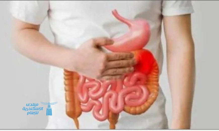 دراسة جديدة تكشف العلاقة بين الجهاز الهضمي وبداية التصلب المتعدد