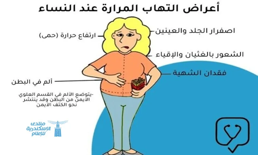 كل ما تحتاج معرفته عن أعراض حصوات المرارة عند النساء ووسائل العلاج الفعالة