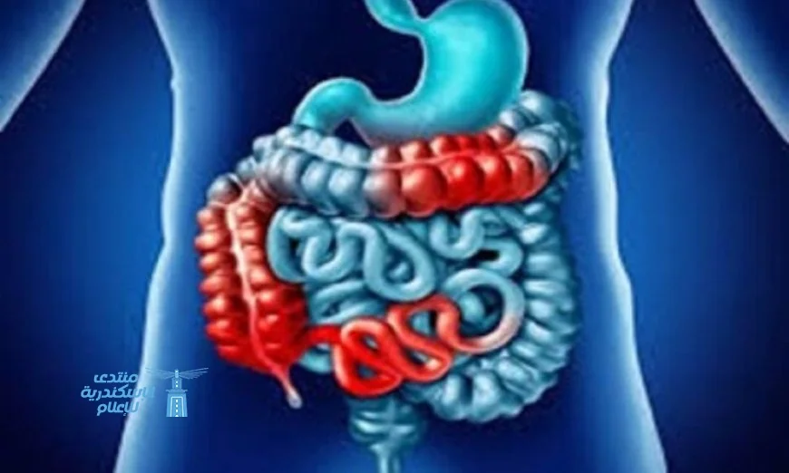 اكتشاف جديد يحقق الأمل لمرضى تليف الأمعاء وينهي معاناتهم